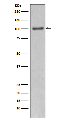 WB - Anti-PI 3 kinase p110 alpha Monoclonal Antibody ABO14359